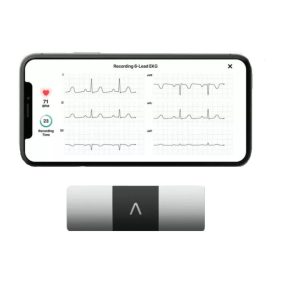 EKG